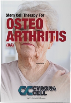 Osteoarthritis eBook