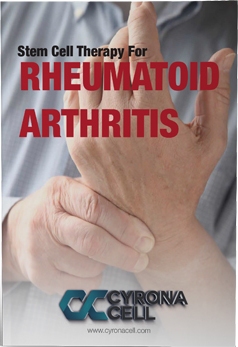 Rheumatoid Arthritis eBook