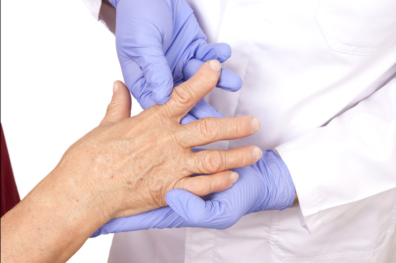 Rheumatoid Arthritis